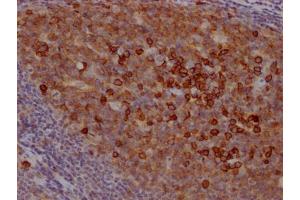 IHC image of ABIN7127402 diluted at 1:100 and staining in paraffin-embedded human tonsil tissue performed on a Leica BondTM system. (Rekombinanter CD38 Antikörper)