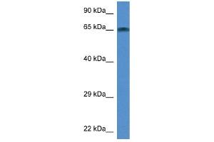 WB Suggested Anti-Taf6l Antibody Titration: 1. (TAF6L Antikörper  (Middle Region))