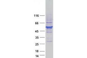 Western Blotting (WB) image for Ring Finger Protein 14 (RNF14) (Transcript Variant 1) protein (Myc-DYKDDDDK Tag) (ABIN2731020)