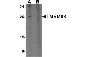 Western blot analysis of TMEM88 in human brain tissue lysate with TMEM88 antibody at 1 μg/ml in (A) the absence and (B) the presence of blocking peptide. (TMEM88 Antikörper  (C-Term))