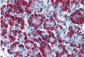 Human Pancreas: Formalin-Fixed, Paraffin-Embedded (FFPE) (SSR1 Antikörper  (AA 33-287))