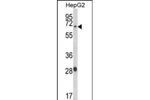 Western blot analysis of WAC Antibody (Center) (ABIN653490 and ABIN2842908) in HepG2 cell line lysates (35 μg/lane). (WAC Antikörper  (AA 284-313))