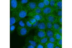 IF analysis of IGF2R using anti-IGF2R antibody (ABIN5693085). (IGF2R Antikörper  (AA 424-529))