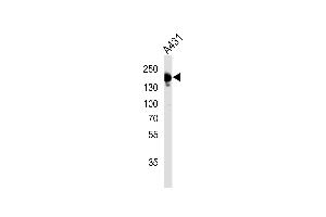 Western blot analysis of lysate from A431 cell line,using EGFR Antibody (Ab-1172)(ABIN483468 and ABIN1532852). (EGFR Antikörper)