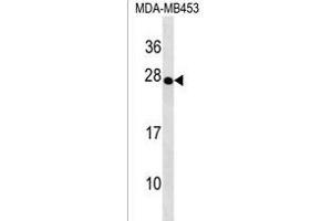 TRDC Antibody (Center) (ABIN1538630 and ABIN2838134) western blot analysis in MDA-M cell line lysates (35 μg/lane). (TRDC Antikörper  (AA 79-106))