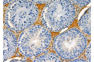 ABIN6263575 and ABIN6273145 at 1/100 staining Mouse testis tissue by IHC-P.