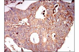 Immunohistochemistry (IHC) image for anti-Syndecan 1 (SDC1) (AA 28-171) antibody (ABIN1724936)