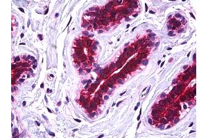 IHC Information: Paraffin embedded breast tissue, tested with an antibody dilution of 5 ug/ml. (SSBP2 Antikörper  (N-Term))