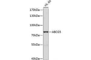 Western blot analysis of extracts of HL-60 cells using ABCG5 Polyclonal Antibody at dilution of 1:1000. (ABCG5 Antikörper)