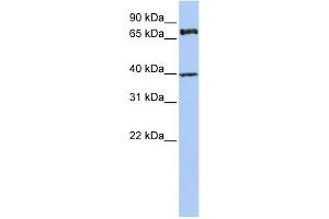 WB Suggested Anti-MPP5 Antibody Titration:  0. (MPP5 Antikörper  (N-Term))