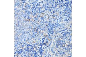 Immunohistochemistry (IHC) image for anti-Complement Component (3d/Epstein Barr Virus) Receptor 2 (CR2) (AA 300-590) antibody (ABIN6138992)