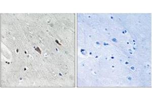 Immunohistochemistry analysis of paraffin-embedded human brain, using Gab2 (Phospho-Tyr643) Antibody. (GAB2 Antikörper  (pTyr643))