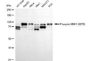 Western blotting analysis using phospho-MSK1 (S376) antibody (ABIN7800235). (Rekombinanter MSK1 Antikörper  (pSer376))