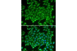 Immunofluorescence analysis of MCF-7 cell using RAB11A antibody. (RAB11A Antikörper  (AA 1-216))