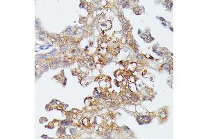 Immunohistochemistry (IHC) image for anti-Mitogen-Activated Protein Kinase Kinase Kinase 4 (MAP3K4) (AA 1-100) antibody (ABIN7268654)