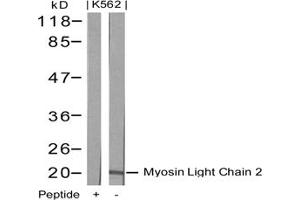 Image no. 2 for anti-Myosin, Light Chain 2, Regulatory, Cardiac, Slow (MYL2) (AA 16-20) antibody (ABIN197362) (MYL2 Antikörper  (AA 16-20))