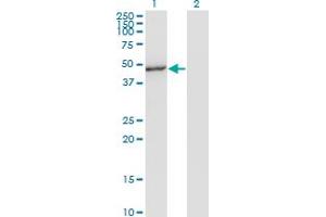 Western Blot analysis of MAPK8 expression in transfected 293T cell line by MAPK8 monoclonal antibody (M05), clone 4H5. (JNK Antikörper  (AA 318-427))
