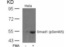 Image no. 1 for anti-SMAD, Mothers Against DPP Homolog 1 (SMAD1) (pSer465) antibody (ABIN319257) (SMAD1 Antikörper  (pSer465))