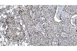IHC analysis of MCM6 using anti-MCM6 antibody (ABIN7600036). (MCM6 Antikörper  (AA 14-821))