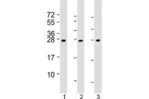 Western blot testing of human 1) human liver, 2) RPMI-8226 and 3) SH-SY5Y lysate with NT5M antibody at 1:2000.