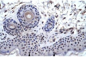 Human Skin; ZNF660 antibody - C-terminal region in Human Skin cells using Immunohistochemistry (ZNF660 Antikörper  (C-Term))