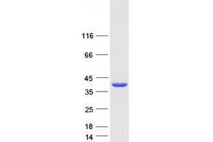 Validation with Western Blot (ANKRD45 Protein (Myc-DYKDDDDK Tag))