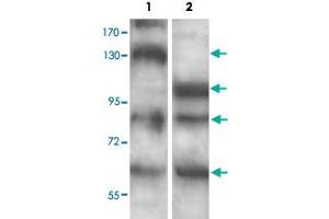Western blot analysis of human fetal brain (Lane 1) and mouse brain (Lane 2) lysate with ADAMTS7 polyclonal antibody  at 1 : 500 dilution.