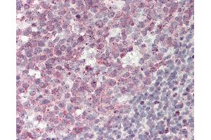 Human Tonsil: Formalin-Fixed, Paraffin-Embedded (FFPE)