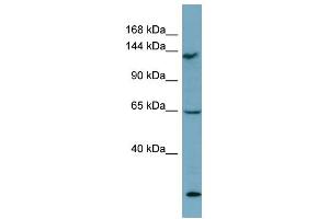WB Suggested Anti-LATS1 Antibody Titration: 0. (LATS1 Antikörper  (Middle Region))