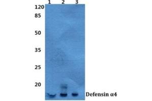 Western blot analysis of Defensin alpha 4 antibody at a 1/500 dilution. (DEFA4 Antikörper)