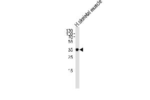 Western blot analysis of lysate from human skeletal muscle tissue lysate, using IFNGR2 Antibody at 1:1000. (IFNGR2 Antikörper  (C-Term))