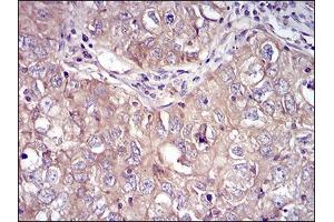 Immunohistochemistry (IHC) image for anti-Ribosomal Protein S6 Kinase, 90kDa, Polypeptide 2 (RPS6KA2) (AA 415-734) antibody (ABIN5542368)