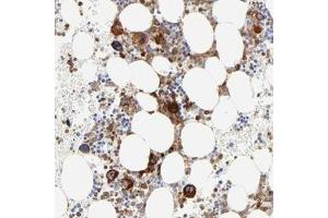 Immunohistochemical staining of human bone marrow with FLNA polyclonal antibody  shows strong cytoplasmic positivity in bone marrow poietic cells at 1:200-1:500 dilution. (Filamin A Antikörper)