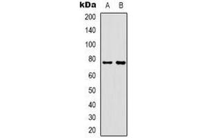 Western blot analysis of Rabphilin 3A expression in Hela (A), mouse muscle (B) whole cell lysates. (RPH3A Antikörper)