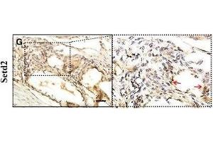 Immunohistochemistry (IHC) image for anti-SET Domain Containing 2 (SETD2) (AA 803-1103) antibody (ABIN1682666)