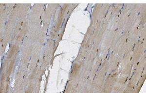 IHC analysis of MEK5/MAP2K5 using anti-MEK5/MAP2K5 antibody (ABIN7602630). (MAP2K5 Antikörper  (AA 9-442))