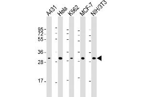Lane 1: A431 Cell lysates, Lane 2: HeLa Cell lysates, Lane 3: K562 Cell lysates, Lane 4: MCF-7 Cell lysates, Lane 5: NIH/3T3 Cell lysates, probed with CDK4 (1529CT850. (CDK4 Antikörper)