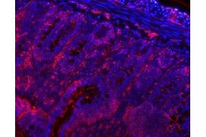 IF analysis of VAPA using anti-VAPA antibody (ABIN7603249). (VAPA Antikörper  (N-Term))