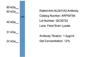 WB Suggested Anti-ALDH1A2  Antibody Titration: 0. (ALDH1A2 Antikörper  (N-Term))