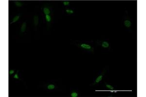Immunofluorescence of monoclonal antibody to CDX4 on HeLa cell. (CDX4 Antikörper  (AA 202-284))