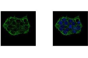 ICC/IF Image EPB41L3 antibody [C3], C-term detects EPB41L3 protein at cytoplasm by confocal immunofluorescent analysis. (EPB41L3 Antikörper  (C-Term))