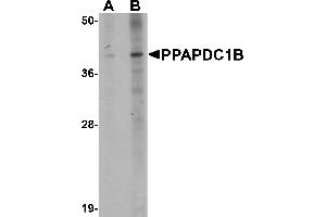 Western blot analysis of PPAPDC1B in EL4 cell lysate with PPAPDC1B antibody at (A) 1 and (B) 2 µg/mL. (PPAPDC1B Antikörper  (N-Term))