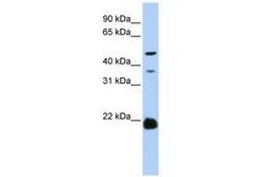 Image no. 1 for anti-Zinc Finger, DHHC-Type Containing 14 (ZDHHC14) (AA 108-157) antibody (ABIN6740780) (ZDHHC14 Antikörper  (AA 108-157))