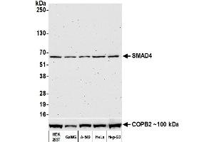 Western Blotting (WB) image for anti-SMAD Family Member 4 (SMAD4) (AA 1-50) antibody (ABIN7455159)