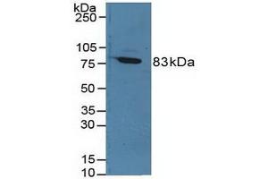 Detection of F13A1 in Rat Serum using Polyclonal Antibody to Coagulation Factor XIII A1 Polypeptide (F13A1) (F13A1 Antikörper  (AA 140-377))