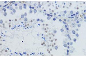 Immunohistochemistry (Paraffin-embedded Sections) (IHC (p)) image for anti-Histone H4 (3meLys20) antibody (ABIN7260402)