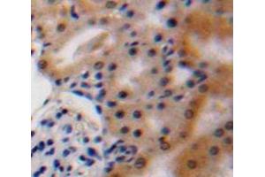 Immunohistochemistry (IHC) image for anti-Vascular Endothelial Growth Factor A (VEGFA) (AA 27-146) antibody (ABIN7429448)
