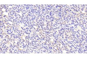 Immunohistochemistry (IHC) image for anti-serpin Peptidase Inhibitor, Clade F (Alpha-2 Antiplasmin, Pigment Epithelium Derived Factor), Member 1 (SERPINF1) (AA 19-417) antibody (ABIN7434440)