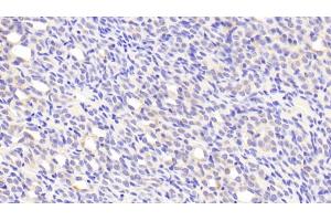Detection of PEDF in Mouse Kidney Tissue using Polyclonal Antibody to Pigment Epithelium Derived Factor (PEDF) (PEDF Antikörper  (AA 19-417))