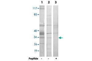 Western blot analysis of extracts from HepG2 cells (Lane 1 and lane 3) and COLO 205 cells (Lane 2), using HNRNPC polyclonal antibody . (HNRNPC Antikörper)